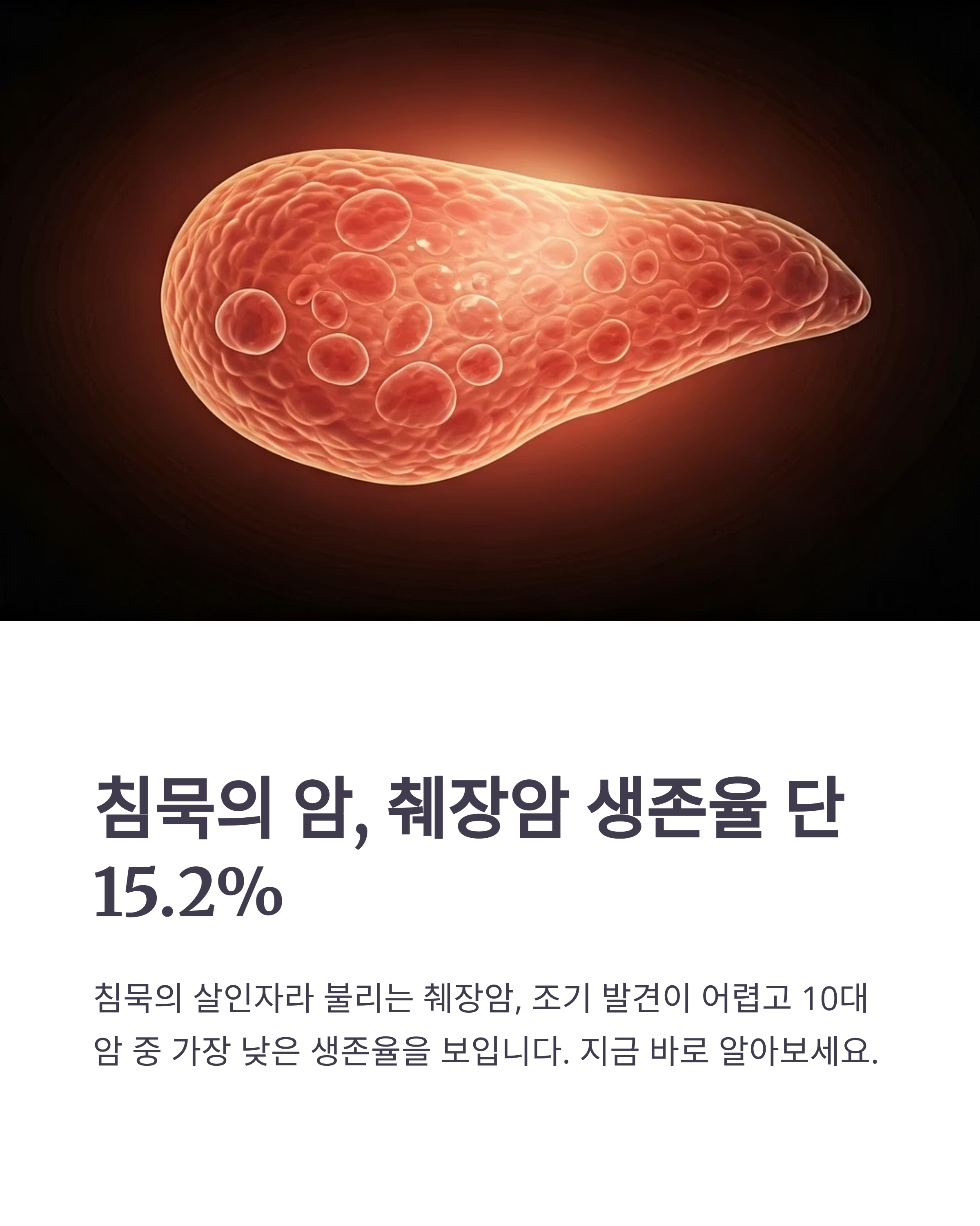 췌장암 생존율
