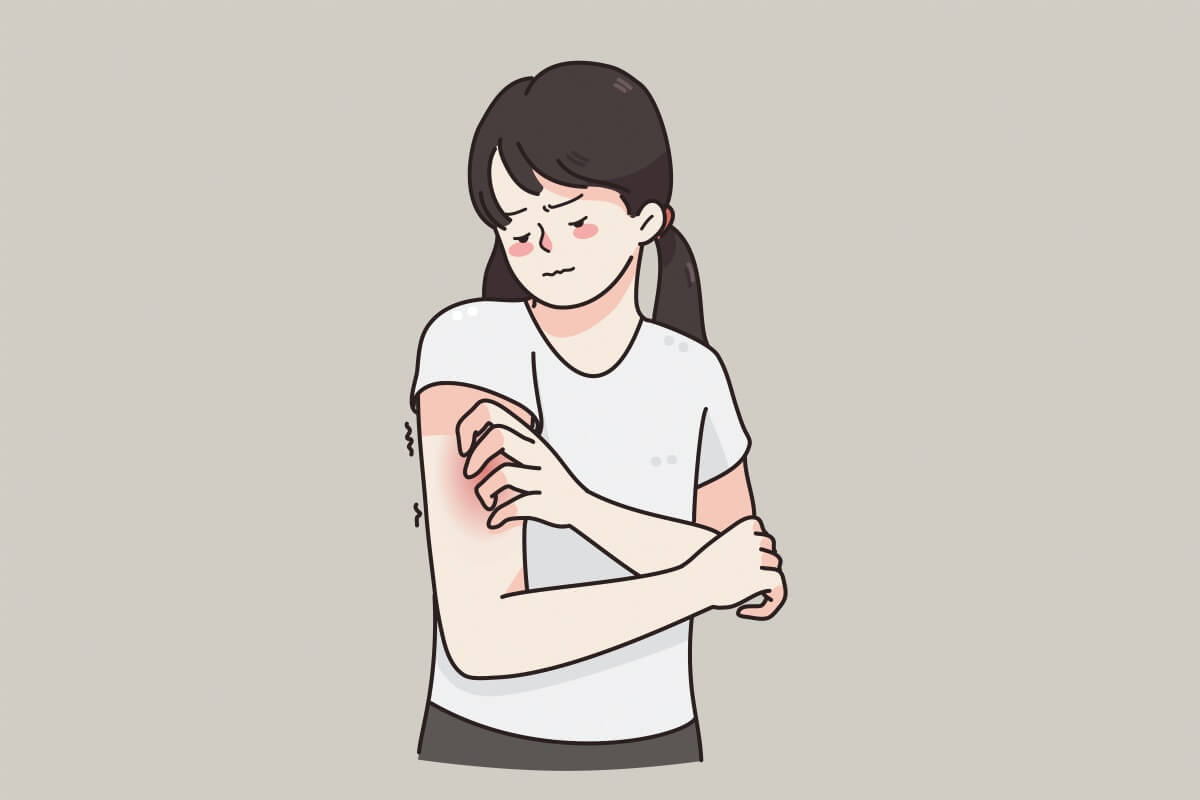 한랭두드러기