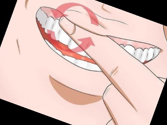 잇몸 내려앉음 치료