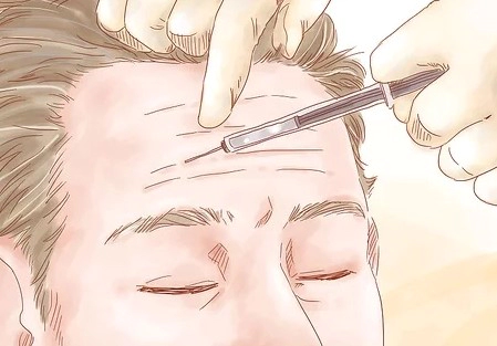 이마 주름 없애는 법