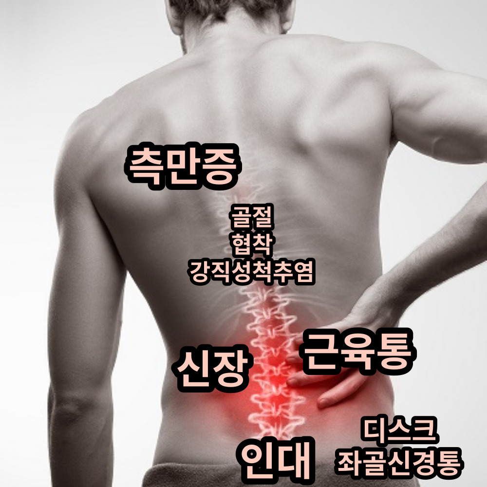 요통-위치