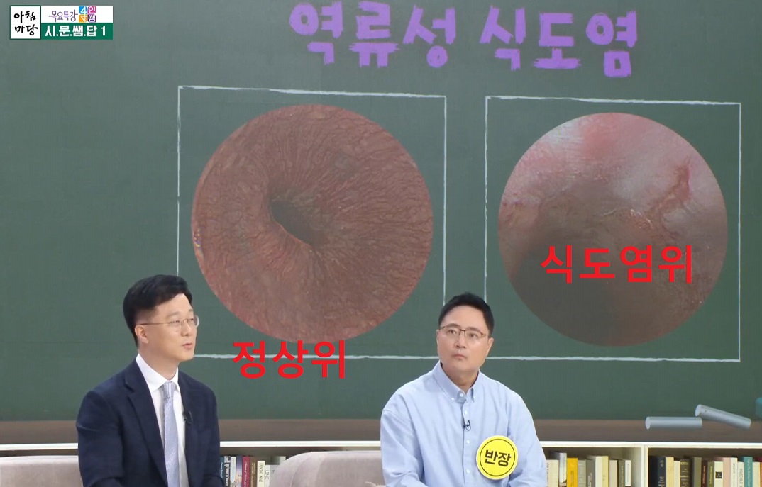 EBS-명의-식도-김도훈-교수-김용희-교수