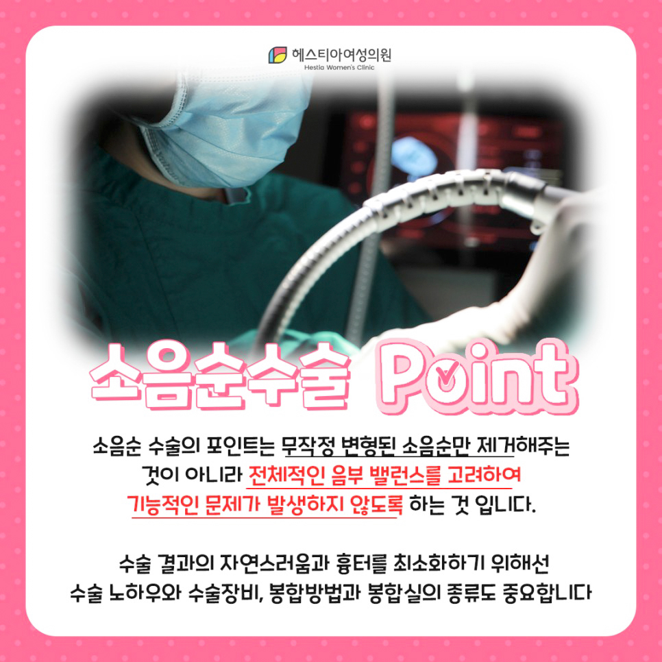 소음순수술 포인트