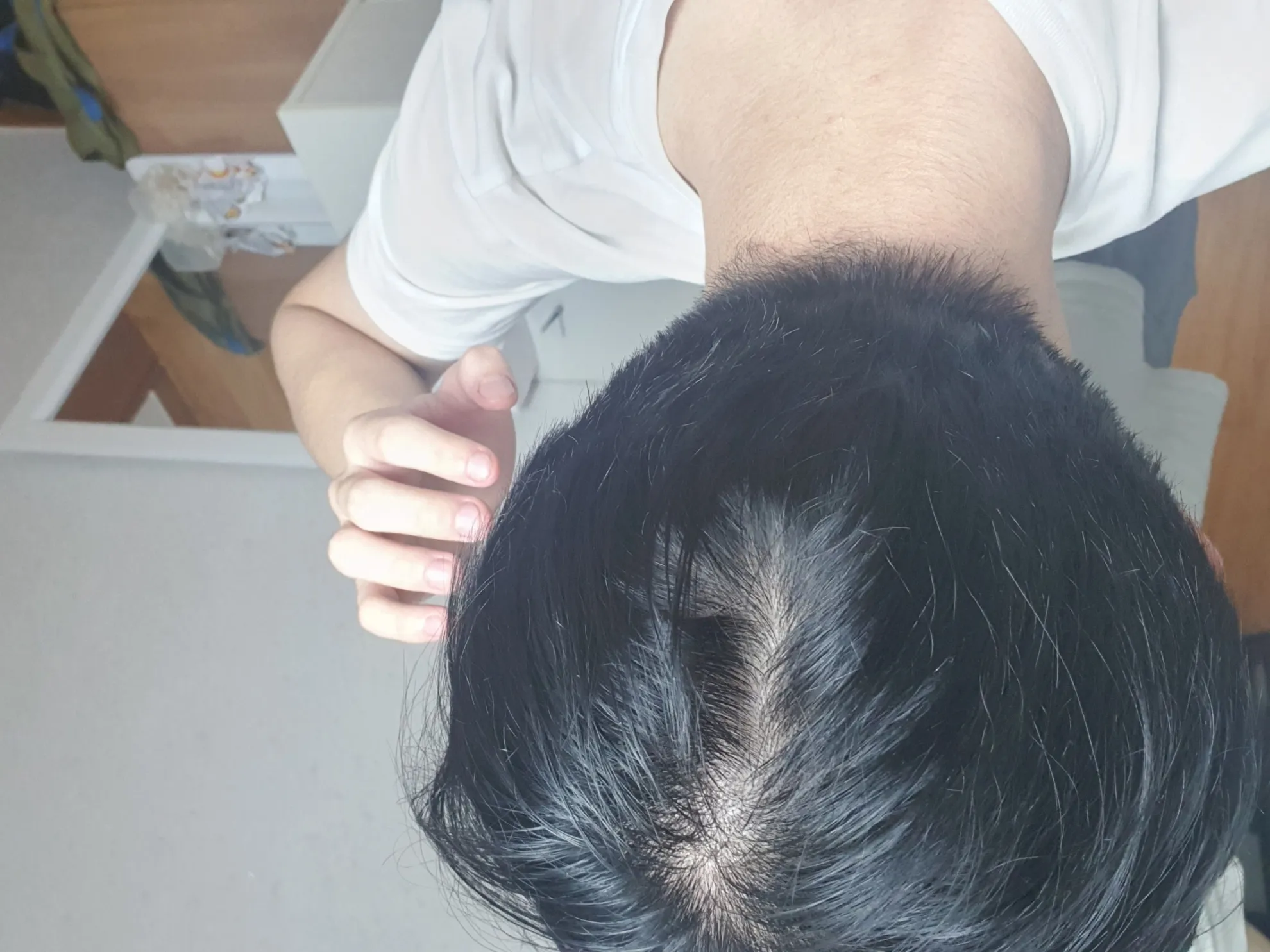 정수리가 아픈 이유와 완화하는 방법_8