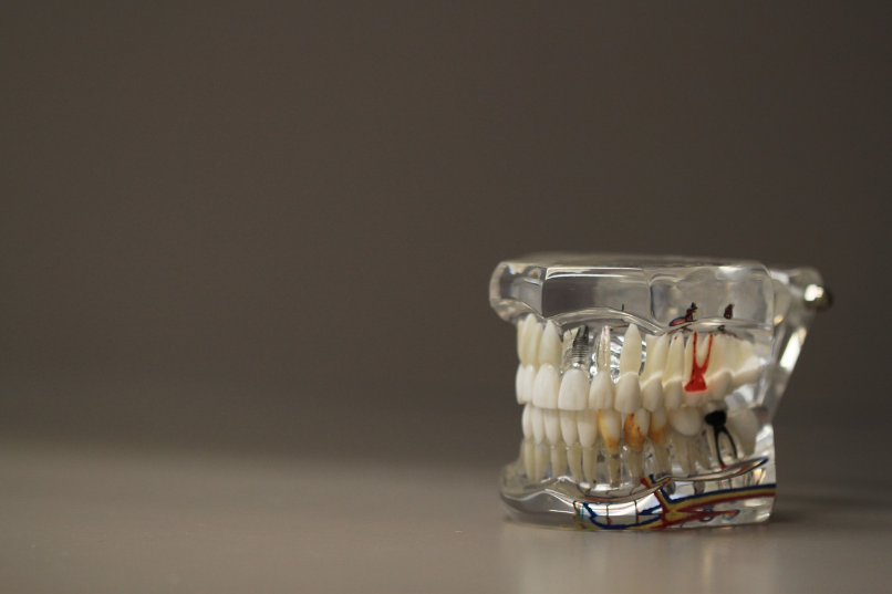 사랑니 발치 _ 치아 이미지