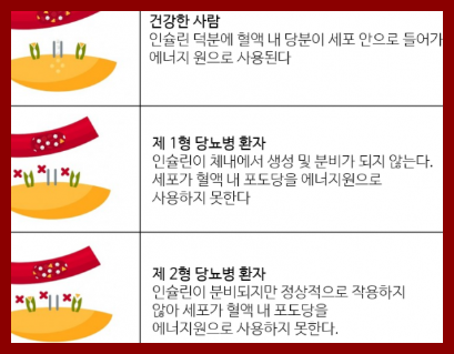 공복혈당 낮추기