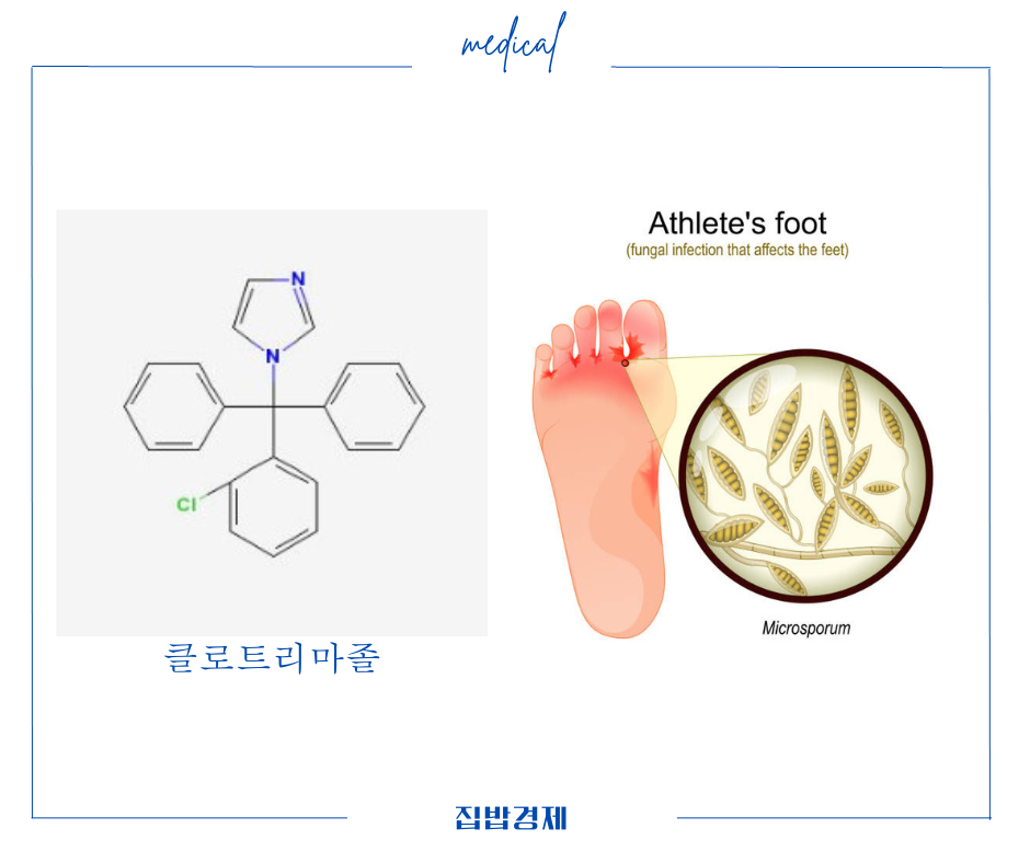 카네스텐 연고 성분 및 효과