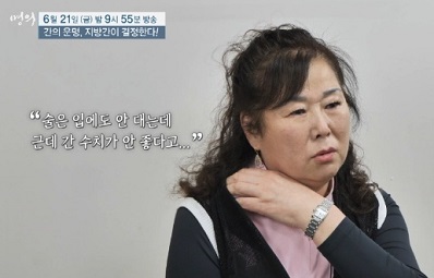 술안마셔도지방간