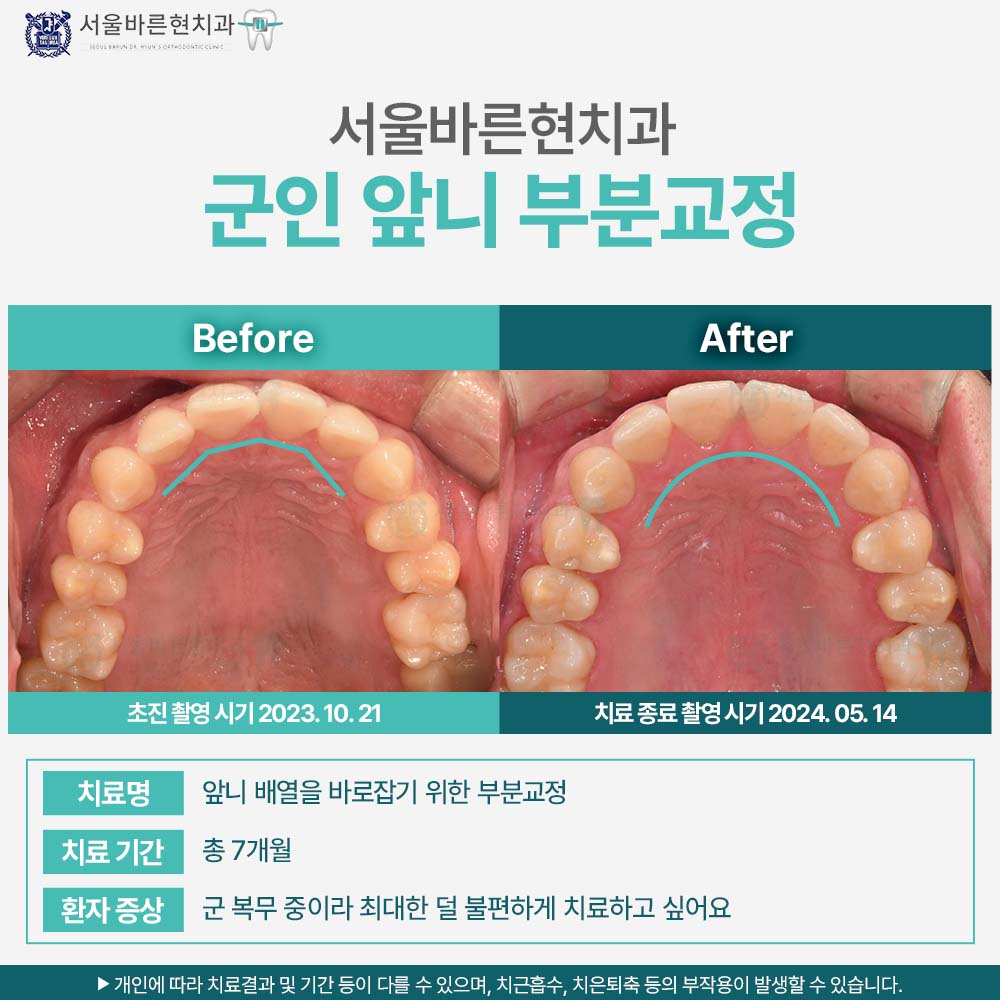부산군인교정