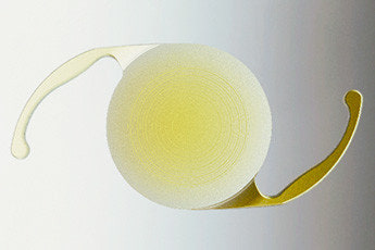 백내장 수술에 사용하는 인공수정체의 모습