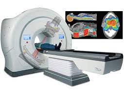 토모테라피(Tomotherapy)