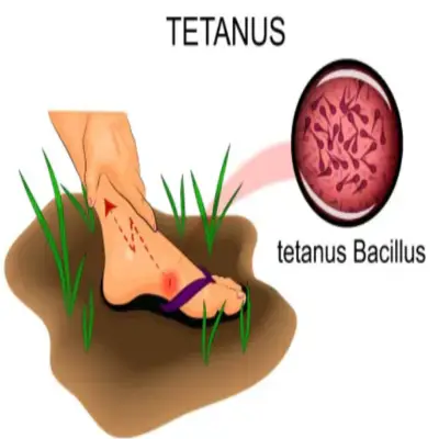 파상풍-예방접종-가격-저렴한-병원찾기-건강