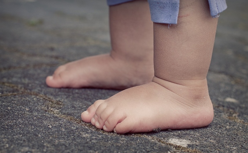 족저근막염 사진 (딱딱한 바닥에 맨발로 서있는 모습)