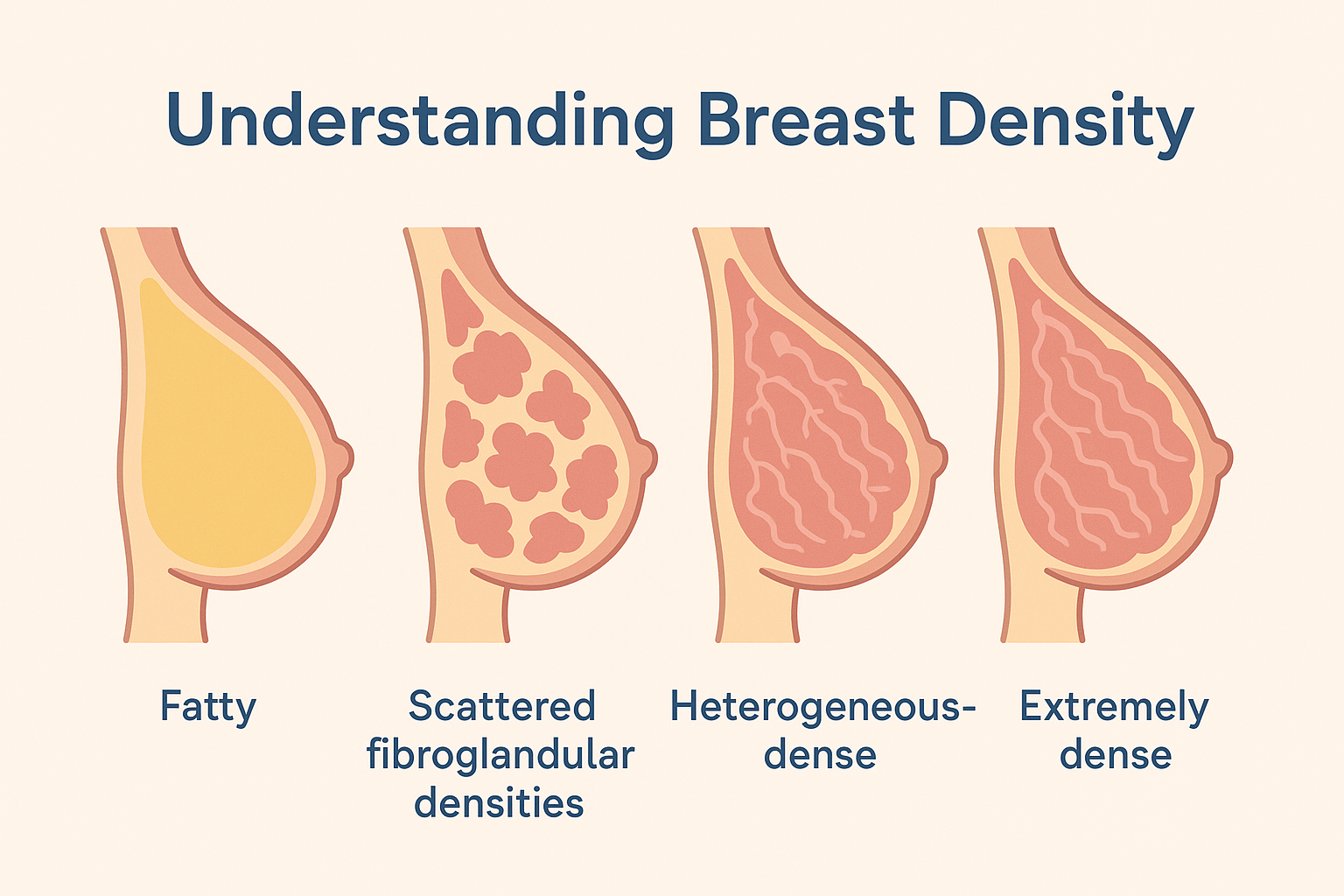 유방 MRI 촬영이 필요한 경우