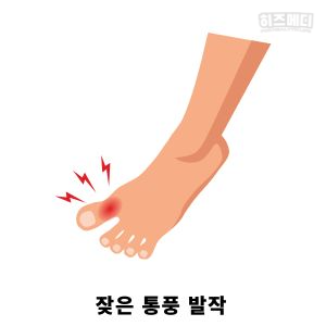 요산수치 낮추는법