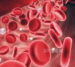 콜레스테롤