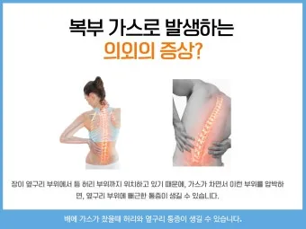 배에 가스가 차고 방귀를 자주 뀜 원인부터 해결책까지 한번에 알아보기_13