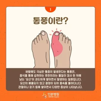 발가락 통풍 증상 및 대처방법_14
