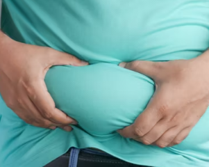 비만 치료 방법 진단기준 예방법