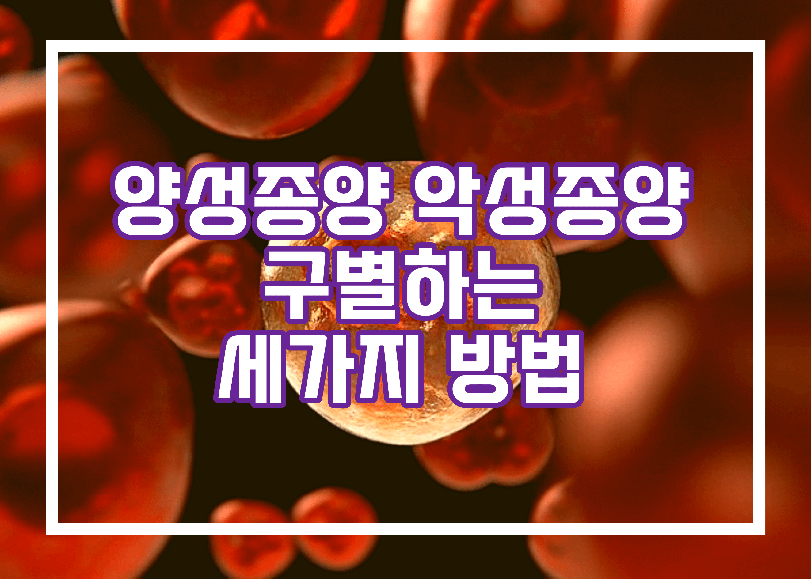 양성종양 악성종양 차이