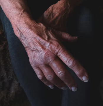 퇴행성 관절염 치료제 예방법 진단기준