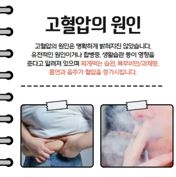 고혈압예방2