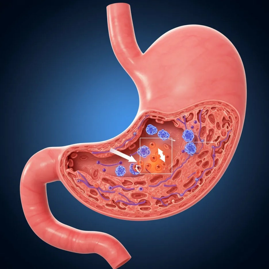 카베진, 위 건강에 어떤 도움을 줄 수 있을까요?