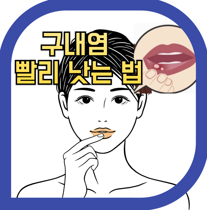 입술에 물집이 생기는 구내염을 나타내는 이미지