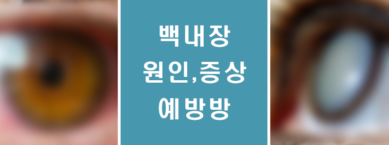 동공-썸네일