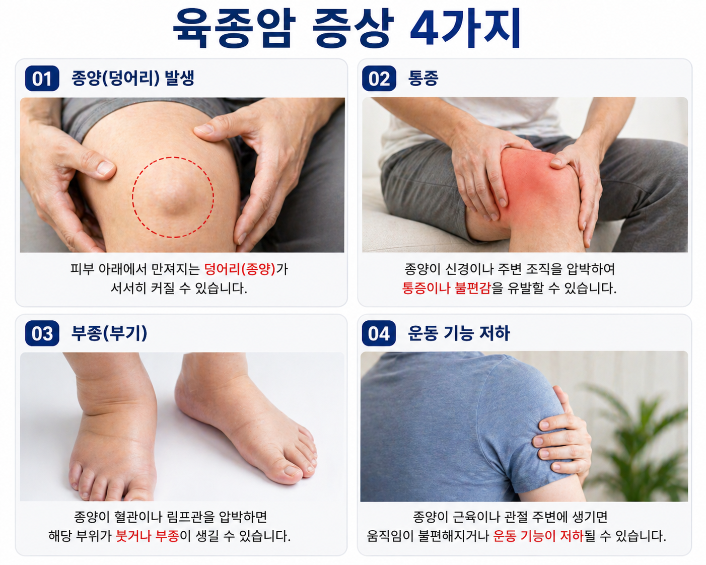 육종암 증상.원인.치료