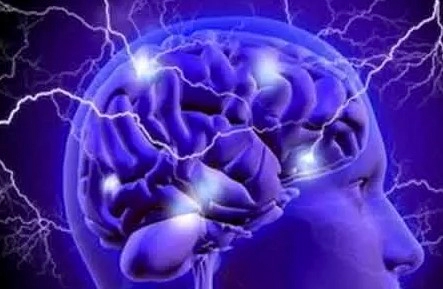 뇌경색 치료방법