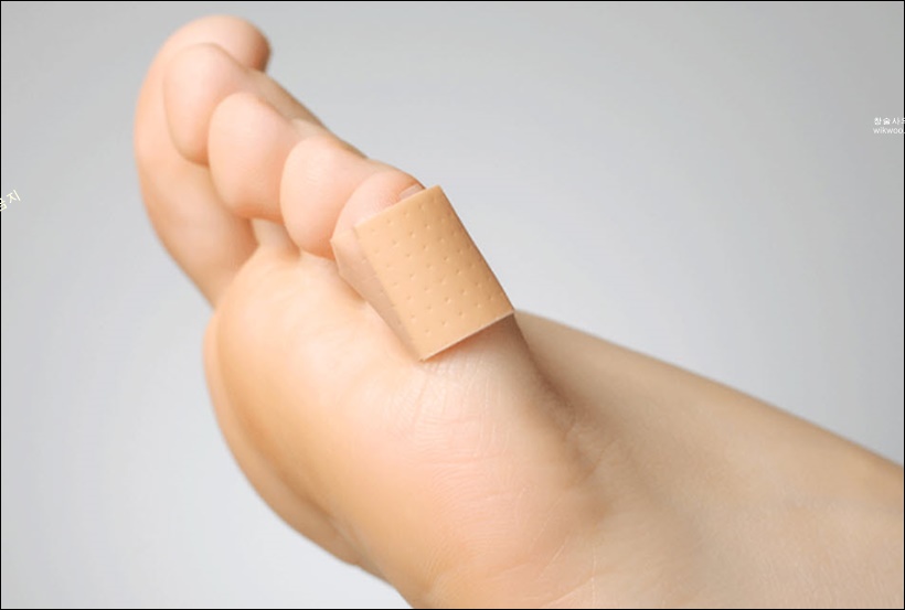 새끼발가락 통증