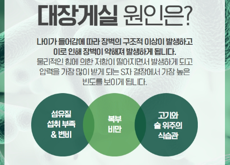 게실염 예방 치료