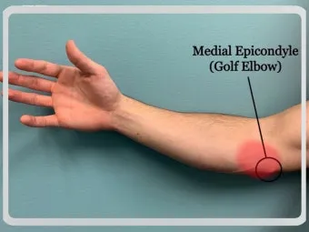 팔꿈치 통증 원인 6가지증상운동법예방법치료법까지_15