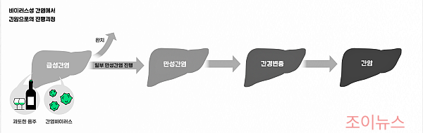 B형간염, 간암의 주범?