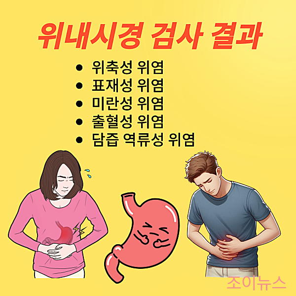 위내시경 검사 결과, 주요 위염의 종류와 특징