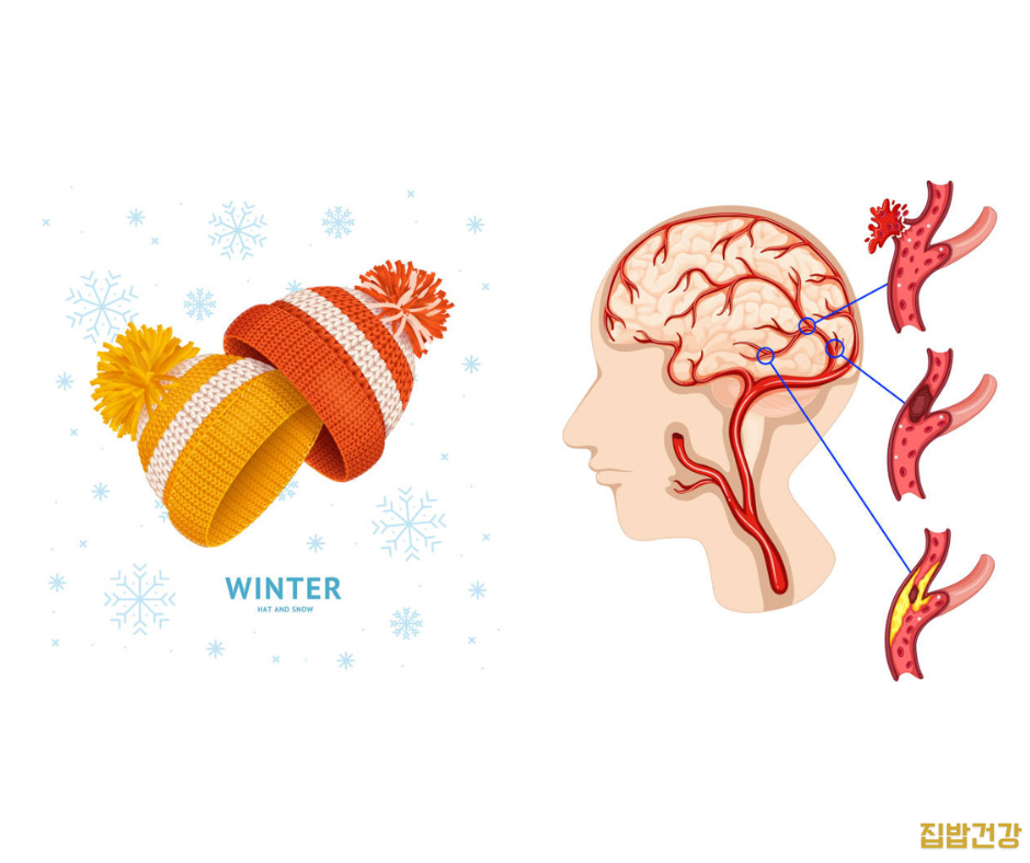 글리아타민정 서론