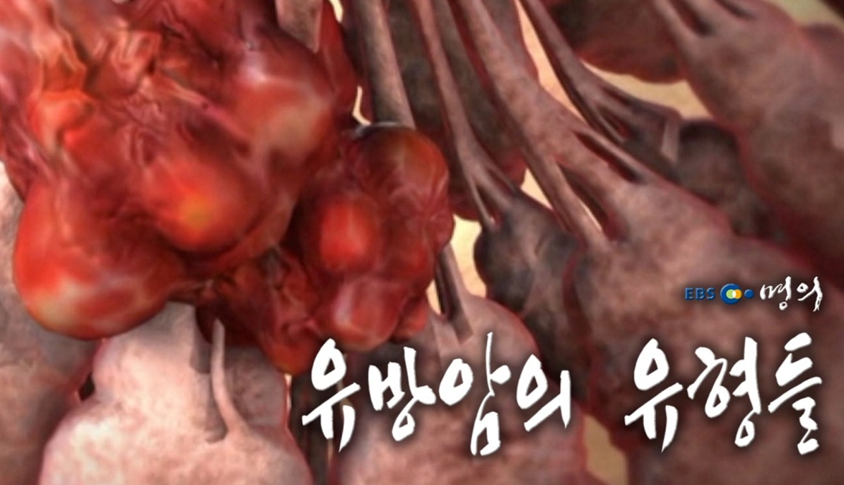 유방내분비외과-우상욱