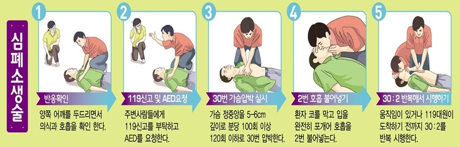 심폐소생술방법