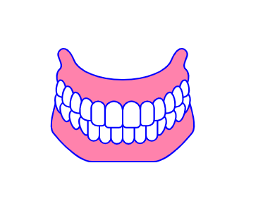 사랑니발치 해야하는 이유