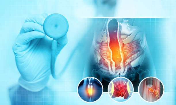 엉덩이 종기 원인과 관리하는 방법, 종기는 누구나 한 번쯤은 겪을 수 있는 흔한 질환이지만, 안일하다고 생각해서 치료를 하지 않는다면 삶의 질이 떨어질 수 있습니다. 특히 엉덩이 종기는 일상생활에 지장을 줄 수 있어 엉덩이 종기의 원인을 파악하고 병변에 맞는 치료를 진행하는 것이 매우 중요합니다. 참고해주세요.