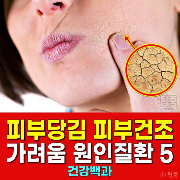 피부당김 얼굴당김 피부건조 가려움 원인