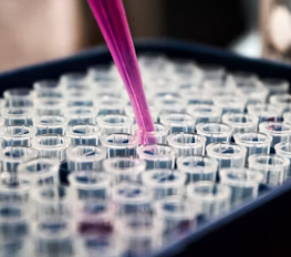 만성 방광염 치료 방법 진단 기준 합병증