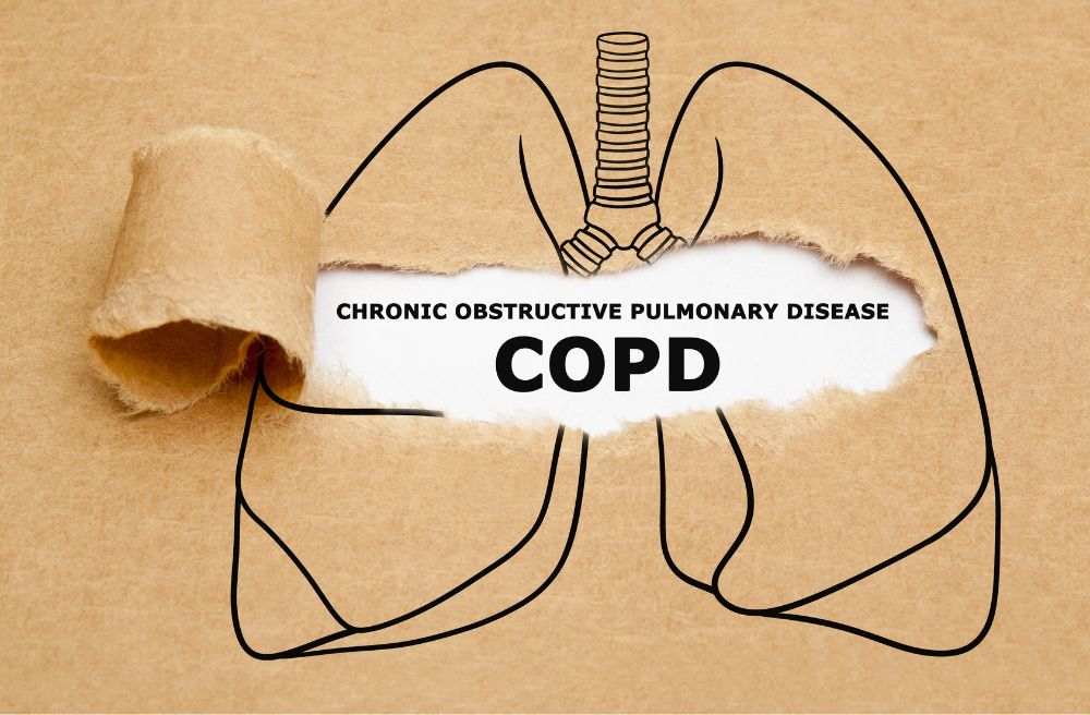 폐쇄성 폐질환(COPD)