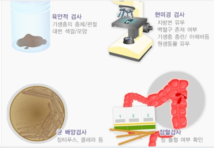 대변 검사