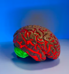 알츠하이머 진단 방법 치료 합병증 예방