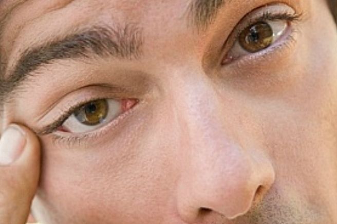 눈꺼풀이 붓는 이유