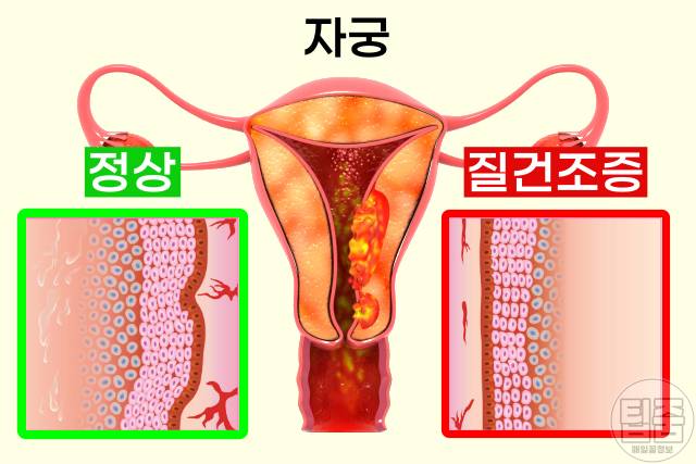 자율신경실조증 자가진단 자율신경계 이상 증상 질건조증