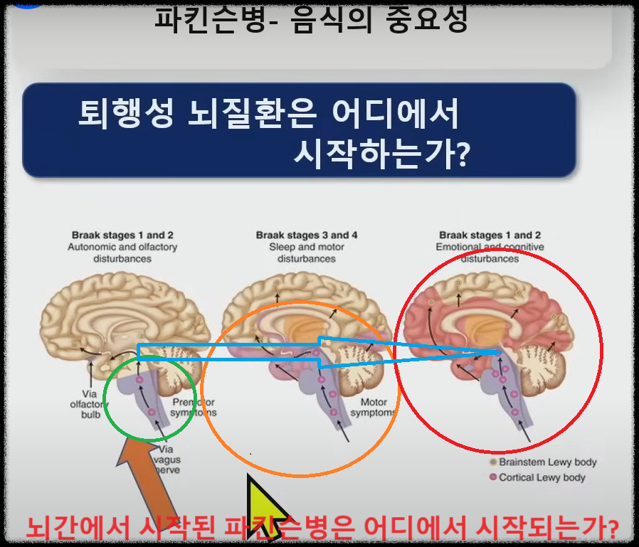 파킨슨병에 효과적인 음식, 건강 보조제