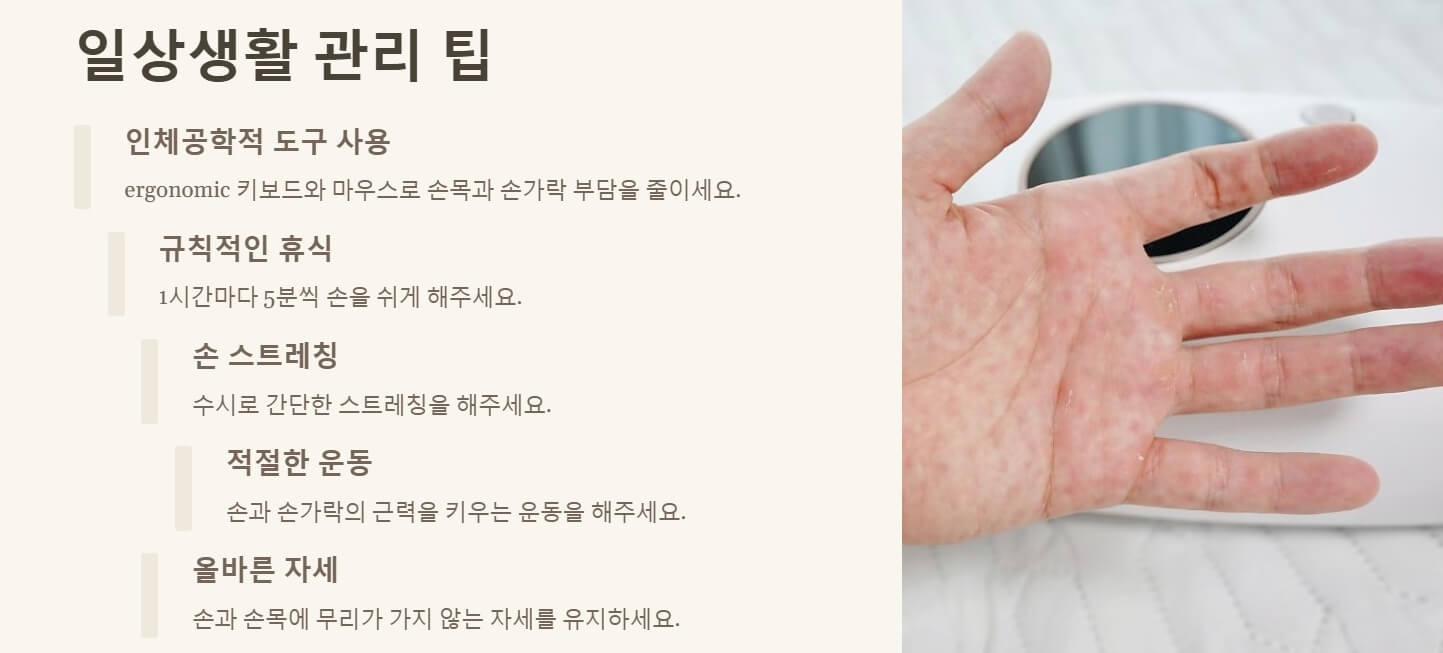 방아쇠 수지 증후근 원인 치료 수술
